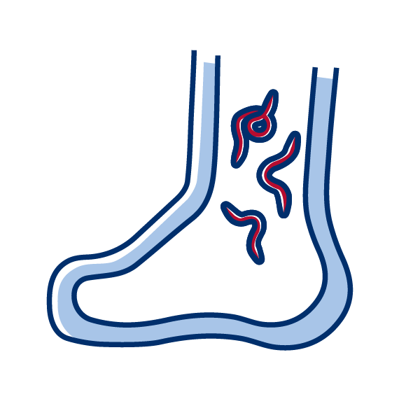 Graphic: Lymphatic Filariasis